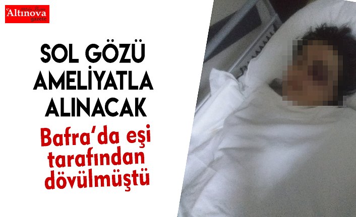 SOL GÖZÜ AMELİYATLA ALINACAK