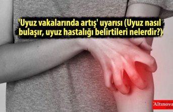 'Uyuz vakalarında artış' uyarısı (Uyuz nasıl bulaşır, uyuz hastalığı belirtileri nelerdir?)