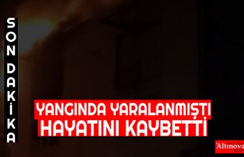 Yangında yaralanan genç kadın öldü