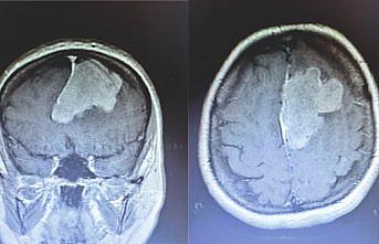 Erbaa'da beyin tümörü ameliyatı yapıldı
