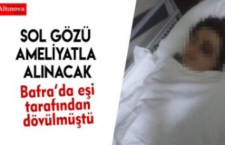 SOL GÖZÜ AMELİYATLA ALINACAK